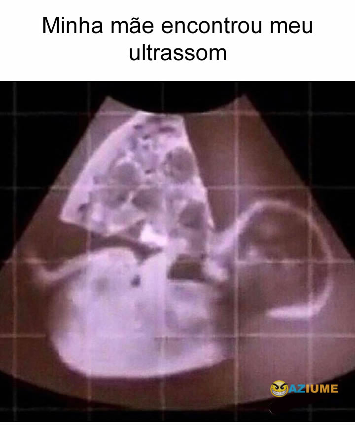 Minha mãe encontrou meu ultrassom