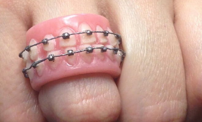 Anel ideal para dentistas Anel ideal para dentistas