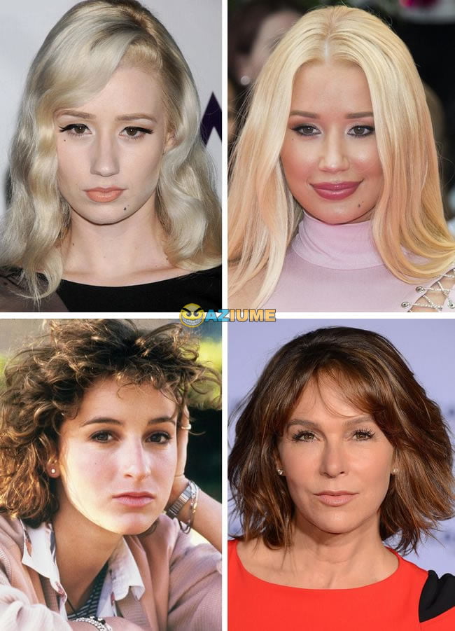 Celebridades antes dos procedimentos estéticos