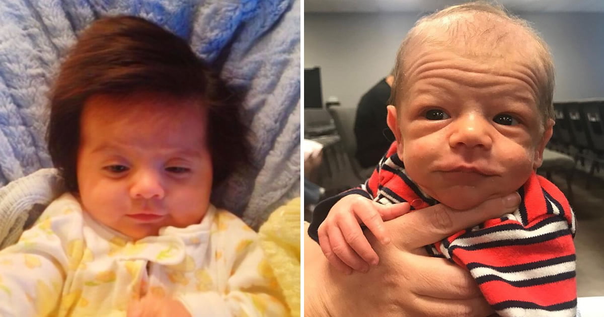 20 vezes em que nenéns nasceram parecendo pessoas velhinhas