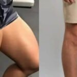 Sua perna tá parecendo de homem