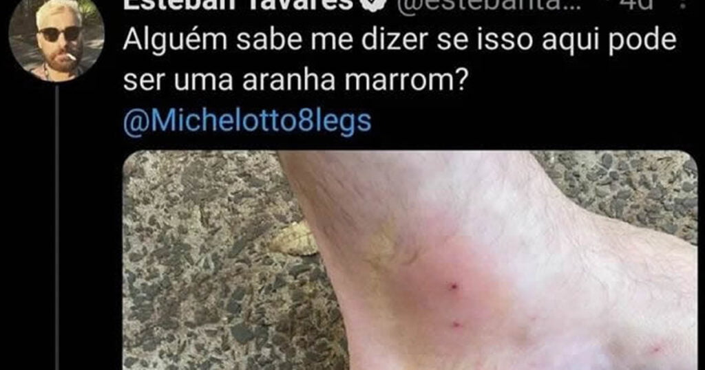 Será que pode ser uma aranha marrom?
