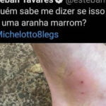 Será que pode ser uma aranha marrom?