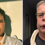 Picadas de abelha: Alternativa natural para preenchimento labial