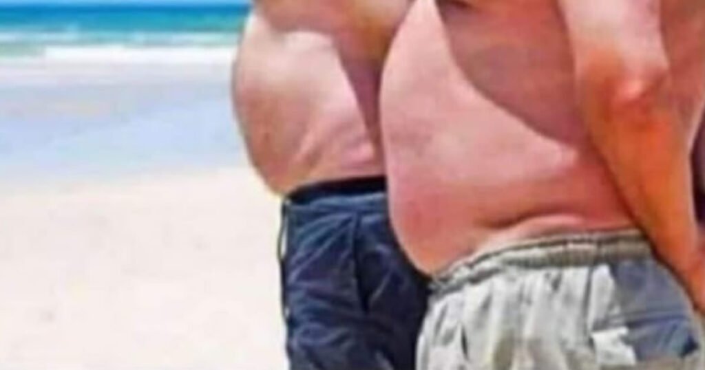 Pesquisa brasileiras sobre obesidade dos homens Pesquisa brasileiras sobre obesidade dos homens