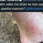 Isso pode ser uma aranha marrom?