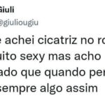 Quando a cicatriz é sexy, mas a origem é 100% galinheiro