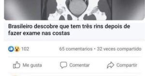 O brasileiro que nasceu com um plano financeiro dentro do próprio corpo