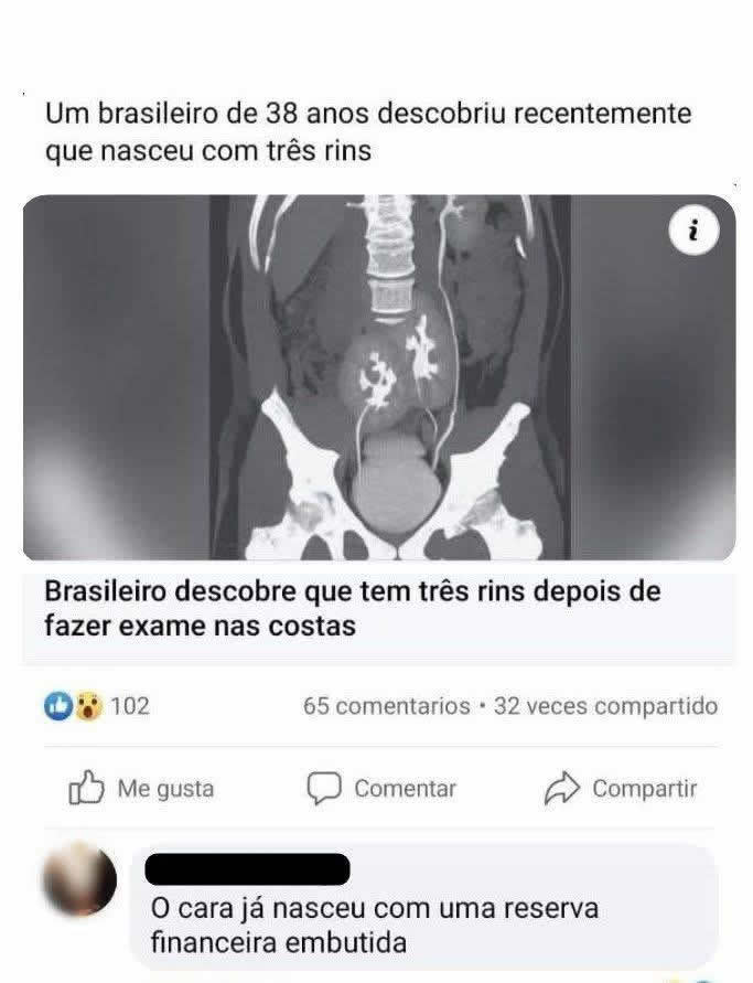 O brasileiro que nasceu com um plano financeiro dentro do próprio corpo